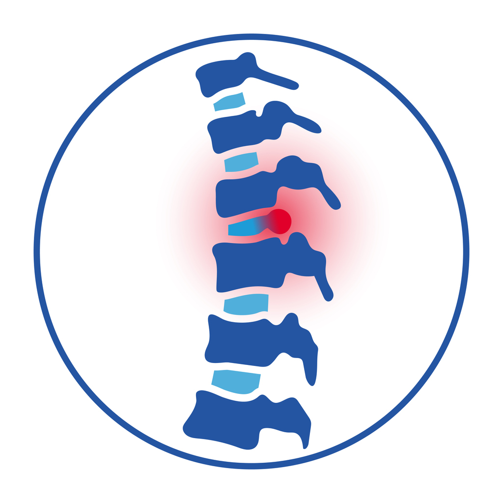 What Is Spinal Cord Injury?